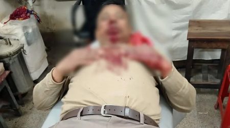 যশোরে বিয়ের দাওয়াত না পেয়ে অবসরপ্রাপ্ত সেনা সদস্যকে কুপিয়ে জখম অবসরপ্রাপ্ত সেনা সদস্যের ওপর কুপিয়ে হামলা