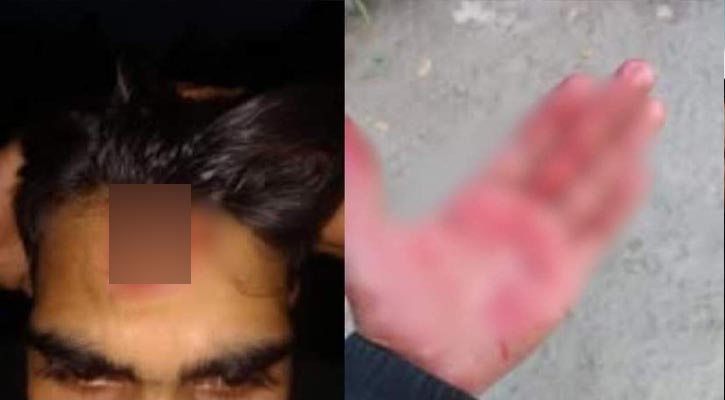 এনসিপি নেতাকর্মীদের ওপর হামলা
